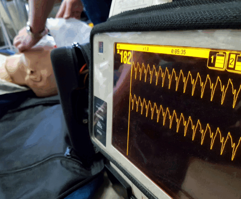 AHA ACLS Advanced Life Support